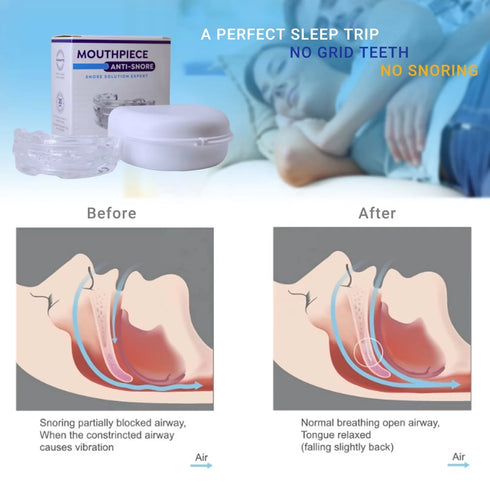 Molding Dental Mouth Guard Teeth Grinding